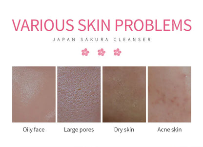 Laikou Sakura Whitening Facial Cleanser (Espuma/Leche Limpiadora Facial de Sakura)